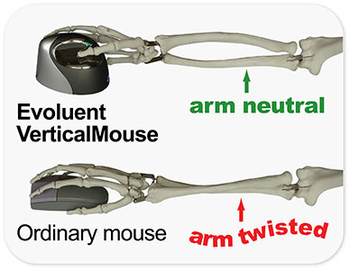 Diagram comparing forearm and wrist posture with a standard mouse versus a vertical mouse